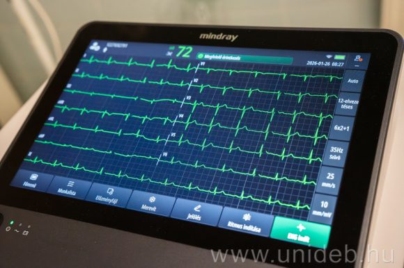 Digitális EKG Debrecenben