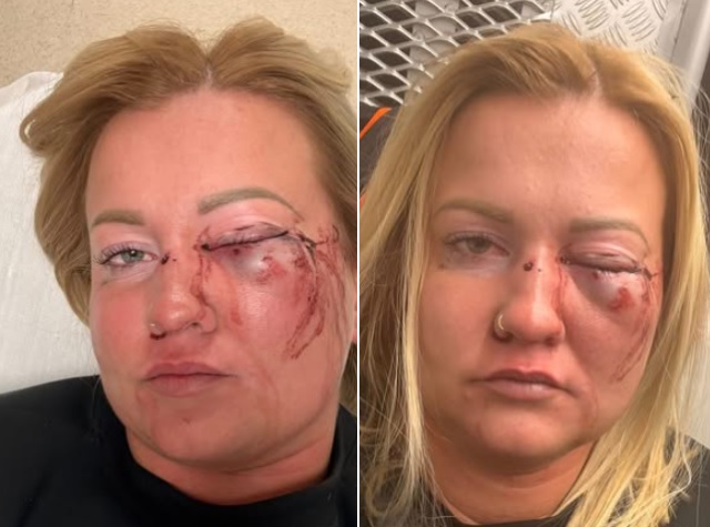 Szentmártonkátai alpolgármester nőverése