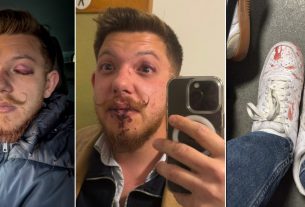 Tiszás szlogent kiabáló fiatalokat vertek össze Sepsiszentgyörgyön